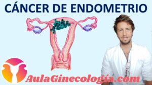 Cancer-de-mama-y-cancer-ginecologico-cancer-de-ovario-de-endometrio