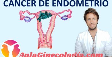 Cancer de mama y cancer ginecologico cancer de ovario de endometrio