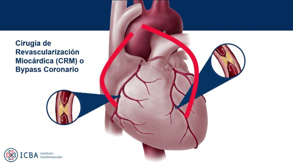 Cirugia cardiaca y vascular