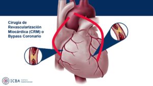Cirugia-cardiaca-y-vascular