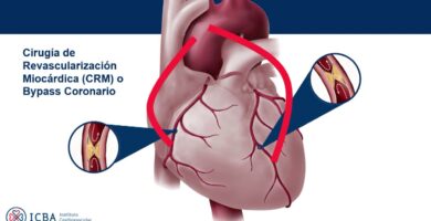Cirugia cardiaca y vascular