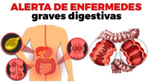 Enfermedades-del-sistema-digestivo