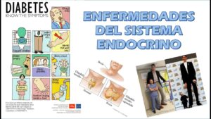 Enfermedades-del-sistema-endocrino