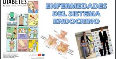 Enfermedades del sistema endocrino