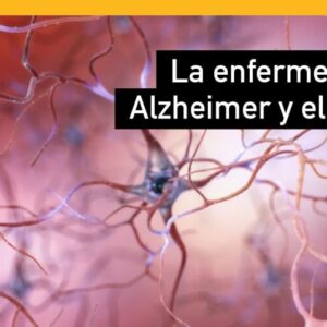 Enfermedad-de-Alzheimer