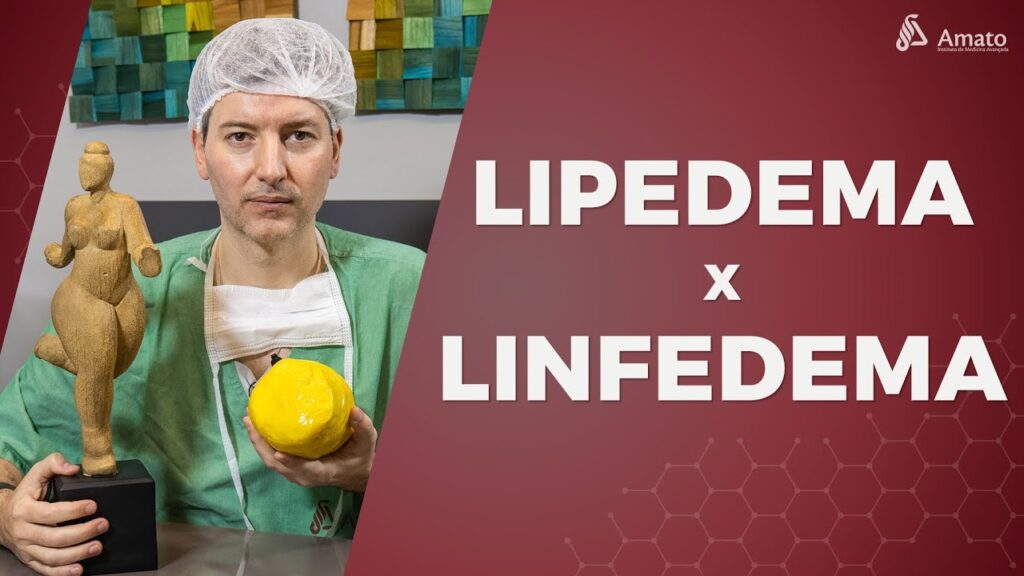 Linfedema Lipedema