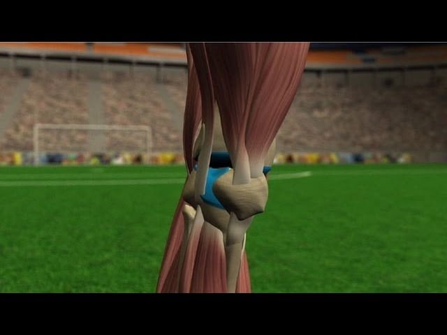 Otras lesiones de rodilla