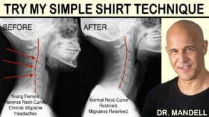 Rectificacion-cervical