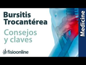 Trocanteritis-Bursitis-trocanterea